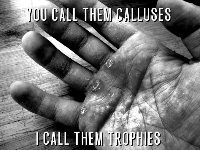 you call them calluses i call them trophies
